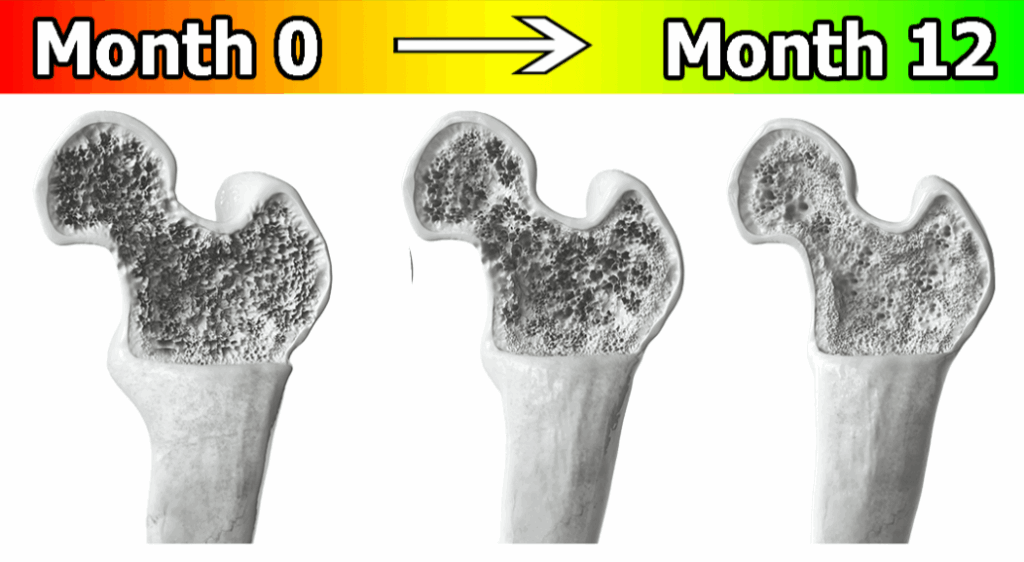 How Does OsteoShield Work